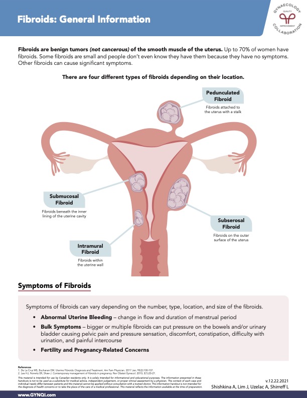 Fibroids General Information