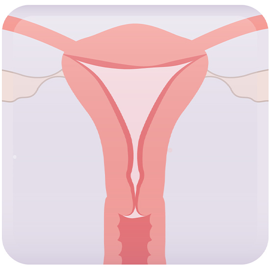 Uterus illustration