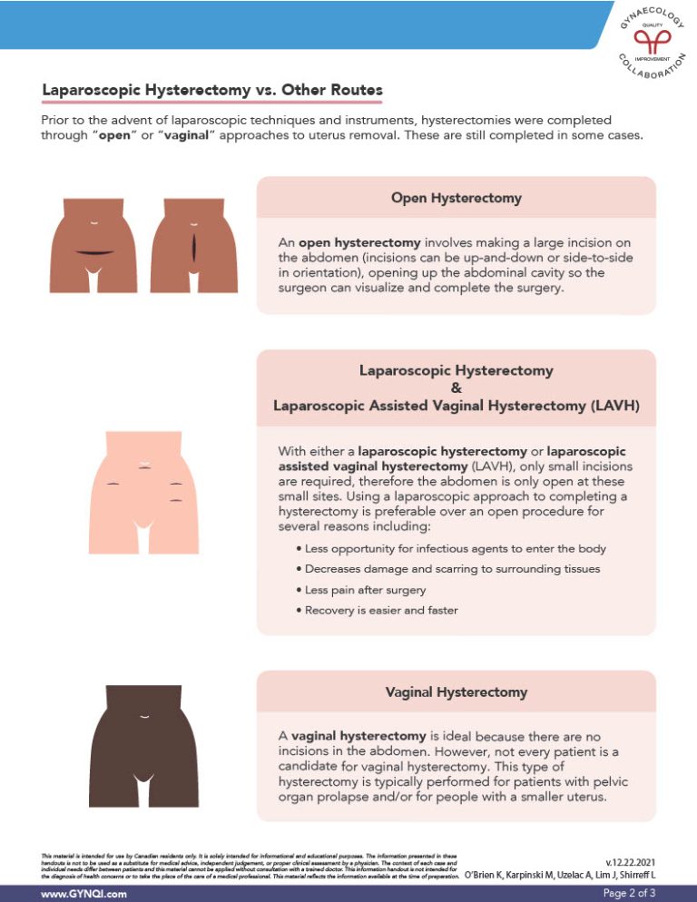 Total Laparoscopic Hysterectomy (PDF Download)