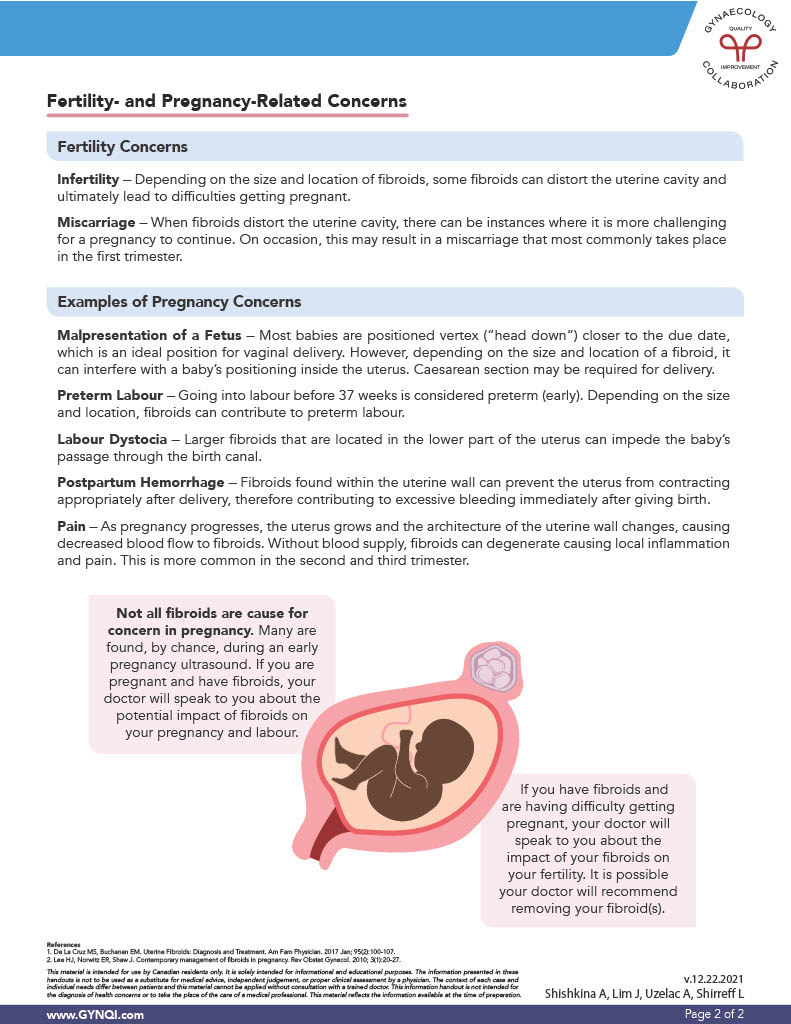 Fibroids Fertility and Pregnancy