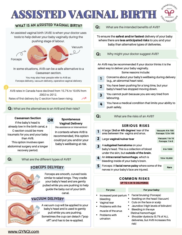Assisted Vaginal Birth Handout