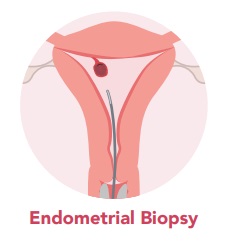 biopsy