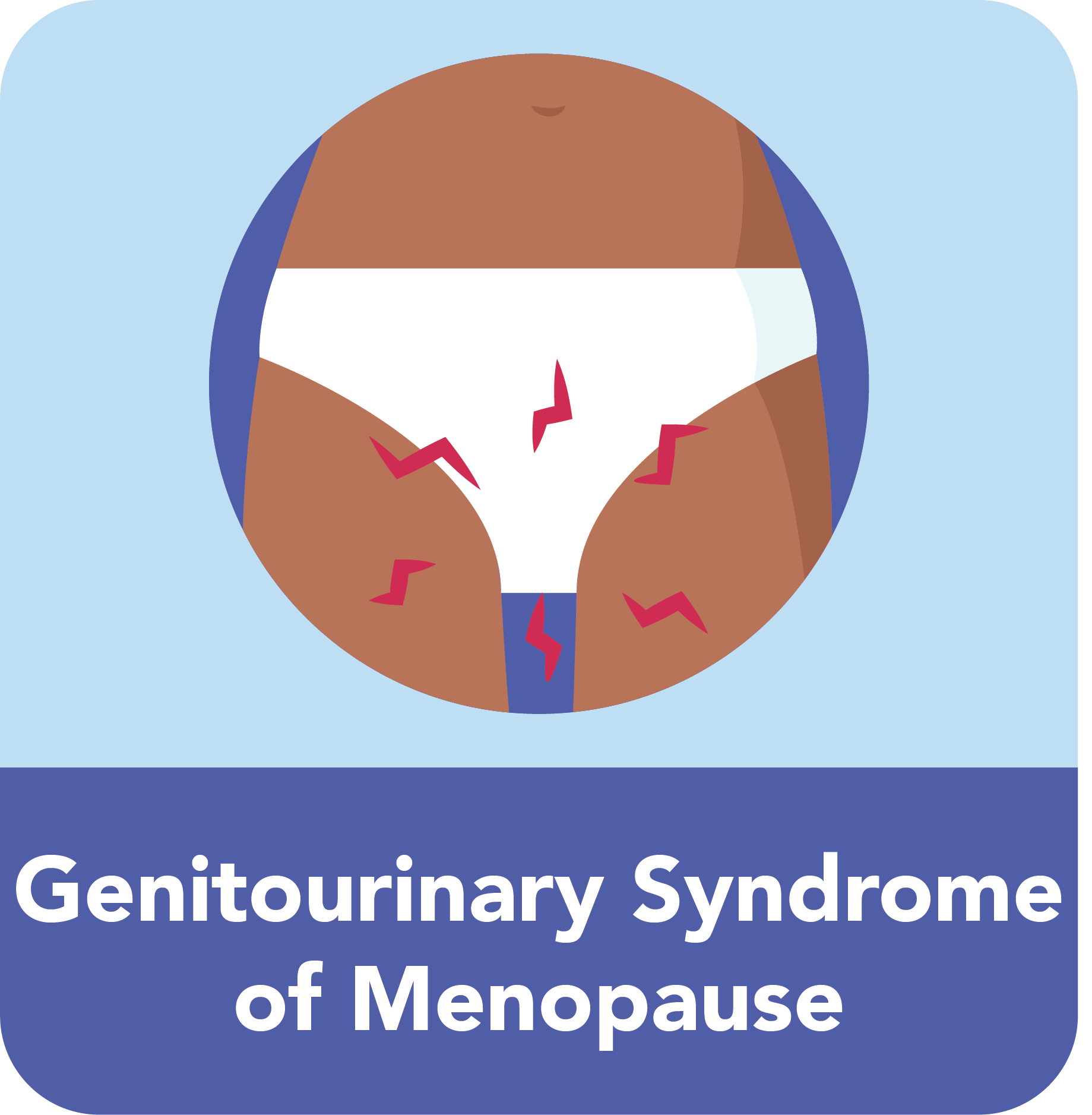 A Comprehensive Guide To Menopause Symptoms & Treatments
