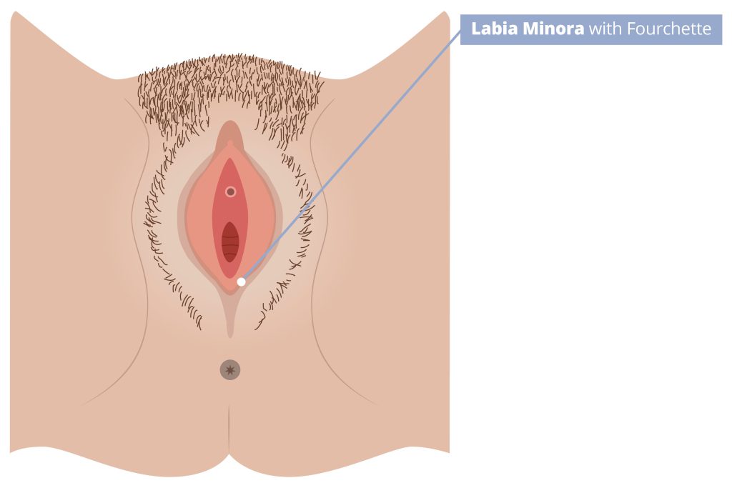 Illustration of external female anatomy pointing out the labia minora with fourchette.