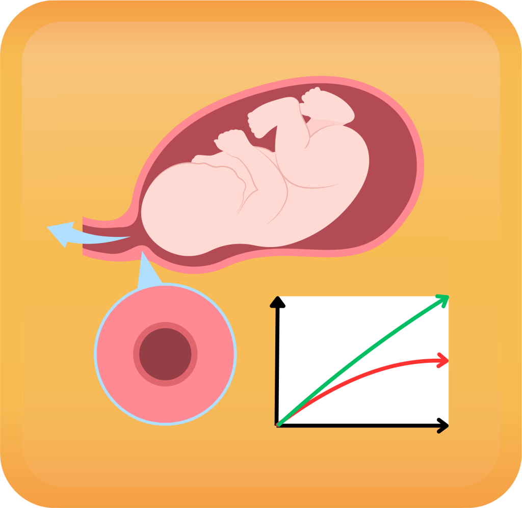 Abnormal Progression of Labour visual