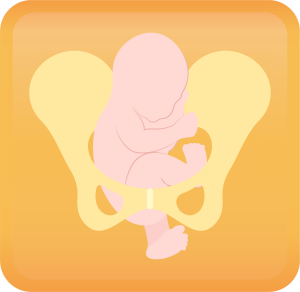 Breech Presentation Handout Button