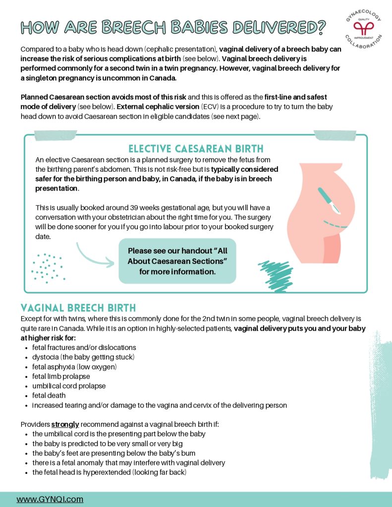 Breech Presentation Handout Image