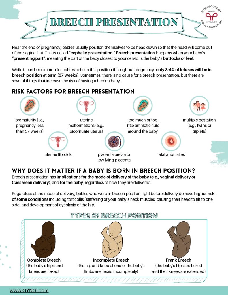 Breech Presentation Handout Image