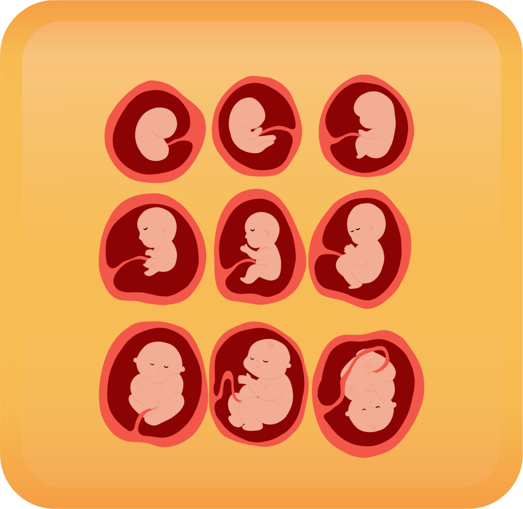Fetal Growth Restriction Handout Button