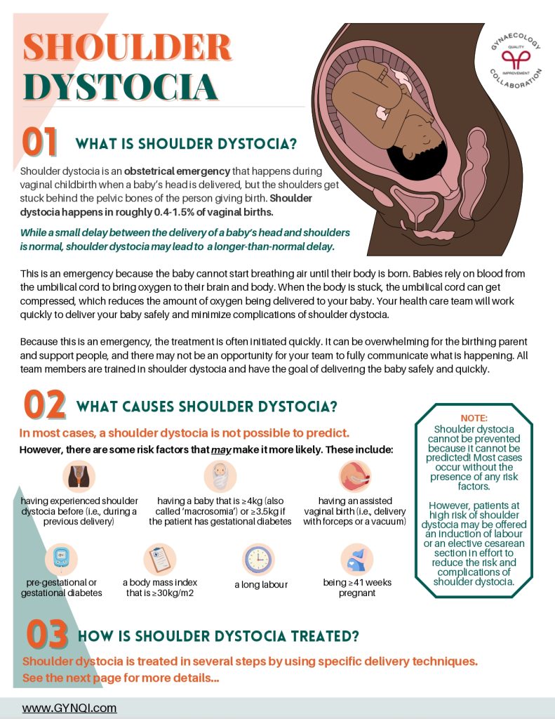 Shoulder Dystocia Handout Image