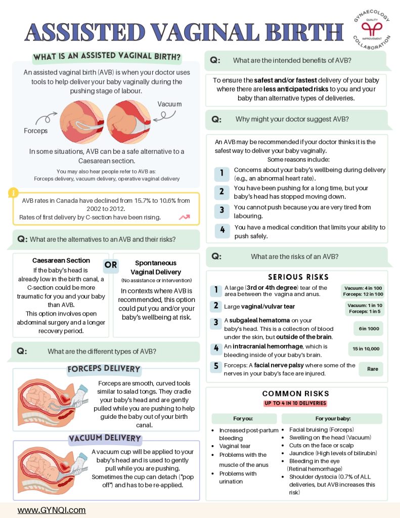 Assisted Delivery Birth Handout Image 1
