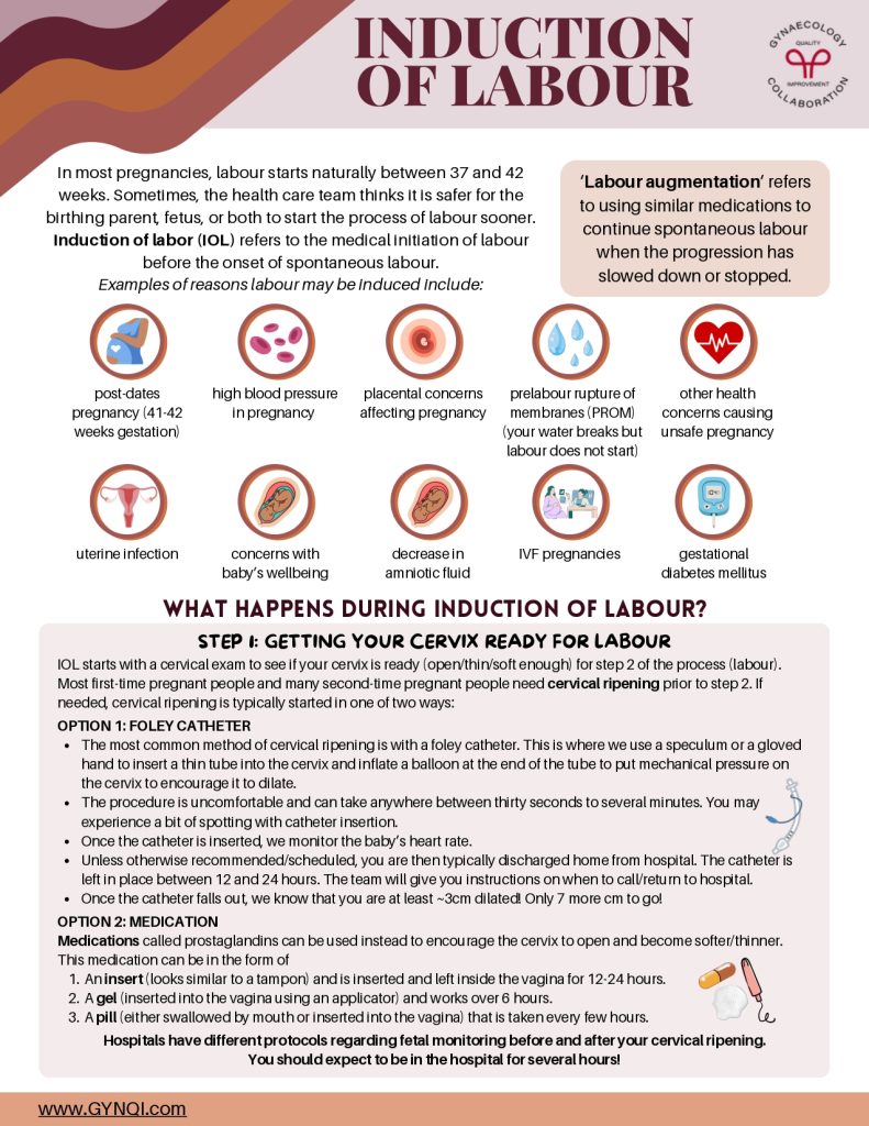 Induction Of Labour Handout Image 3