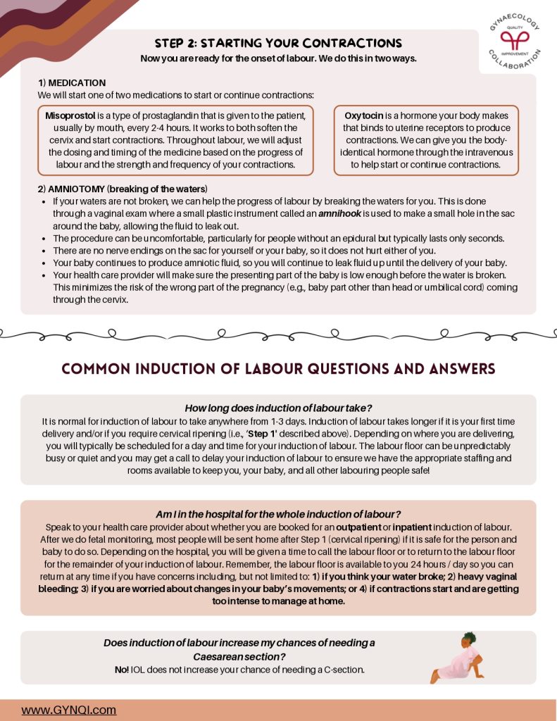 Induction Of Labour Handout Image 2
