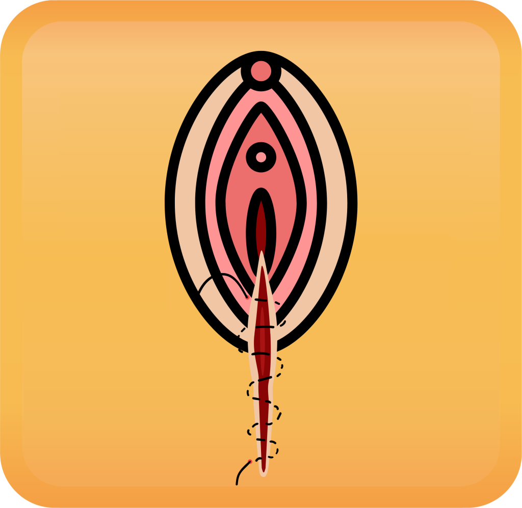 Perineal Lacerations Handout Button