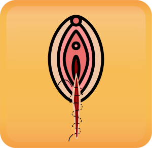 Perineal Lacerations Handout Button